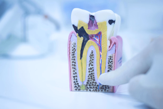 Model of a tooth cross-section showing decay and root canal with a gloved finger pointing at it.