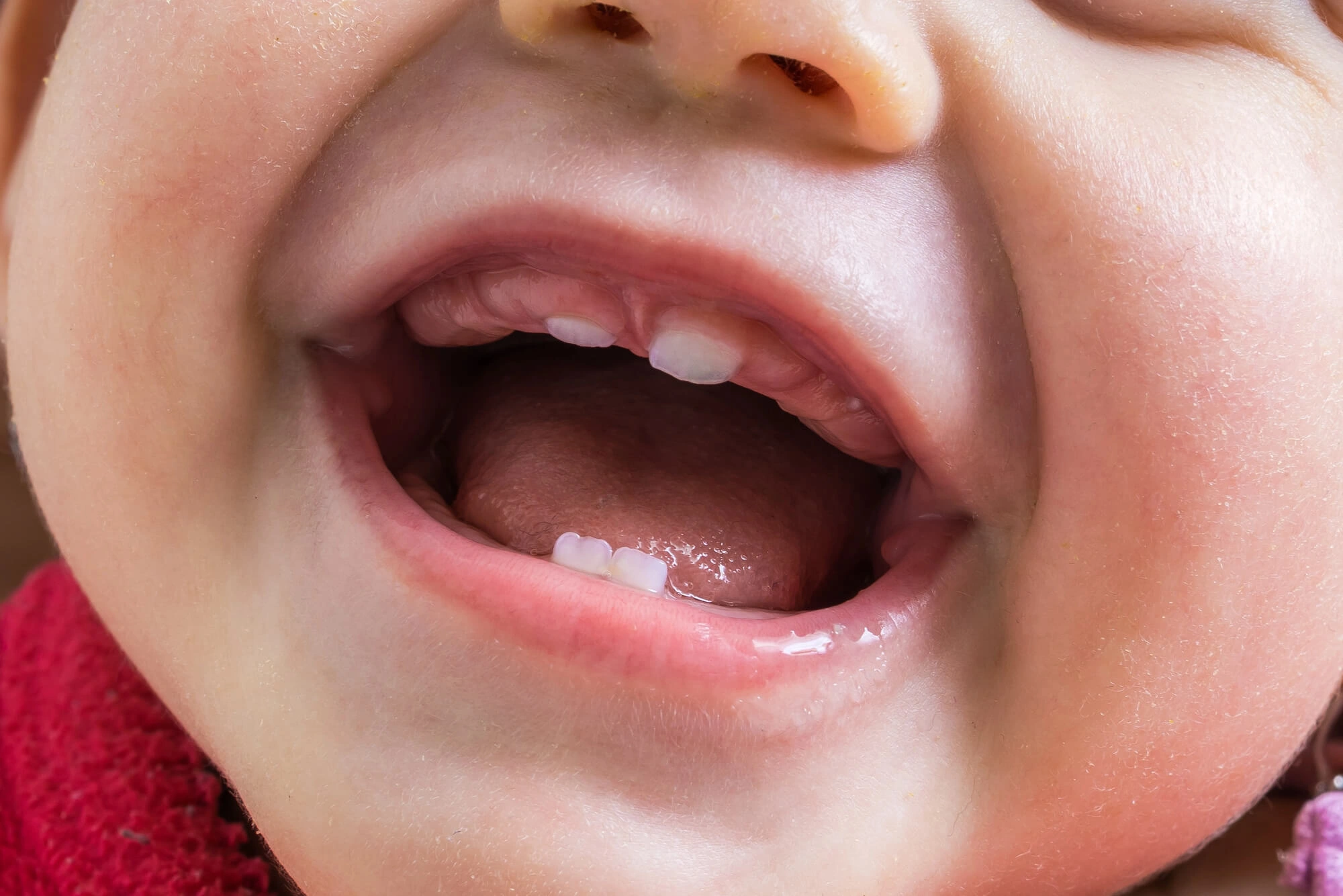 Close-up of a baby's open mouth showing the eruption of four small teeth.