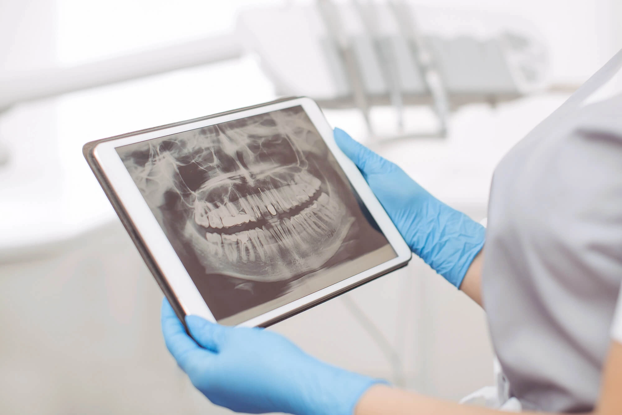 Person wearing blue gloves holding a tablet displaying a dental X-ray image.
