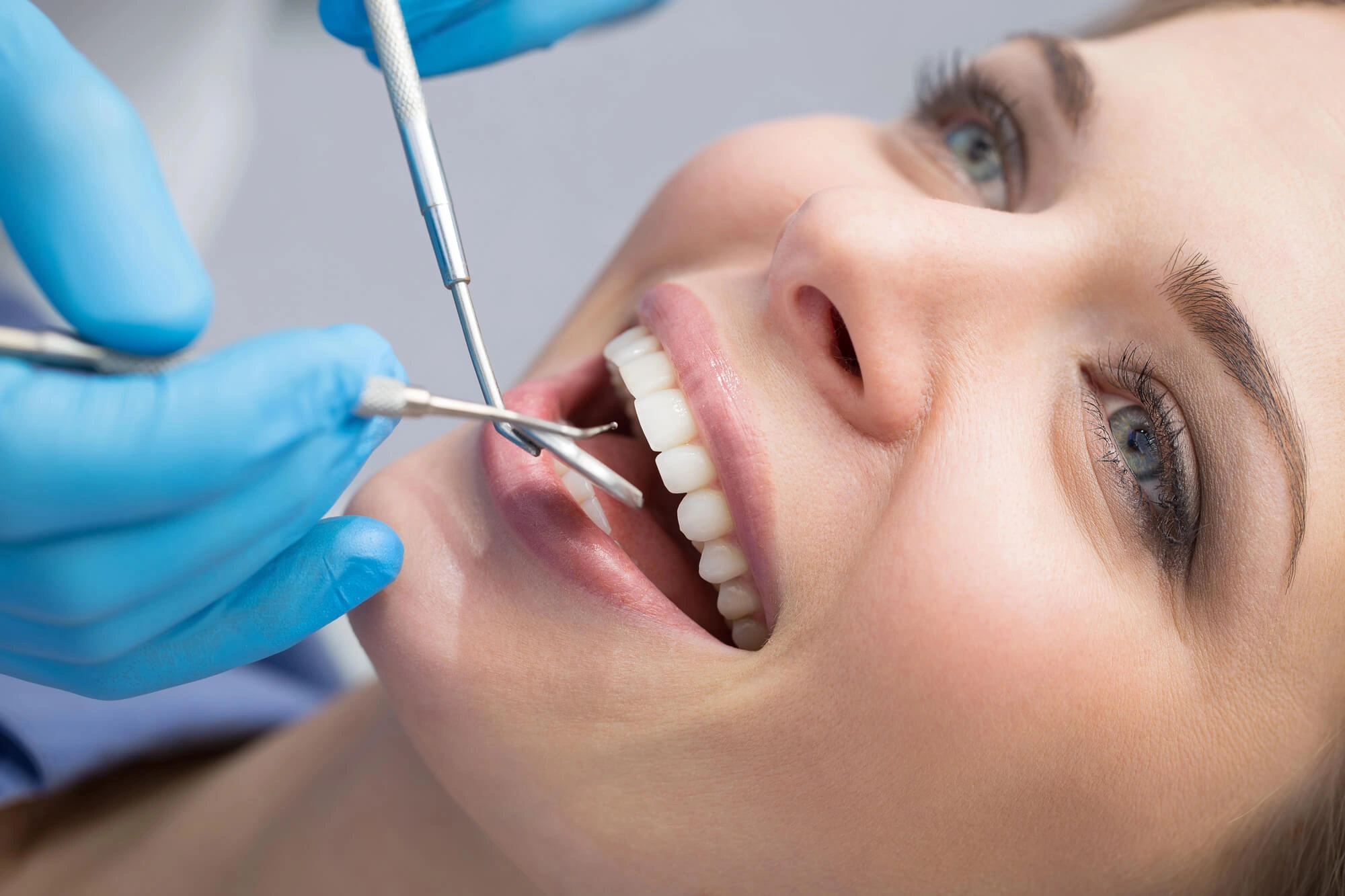 Dental professional wearing blue gloves examining a smiling patient's teeth with dental tools.