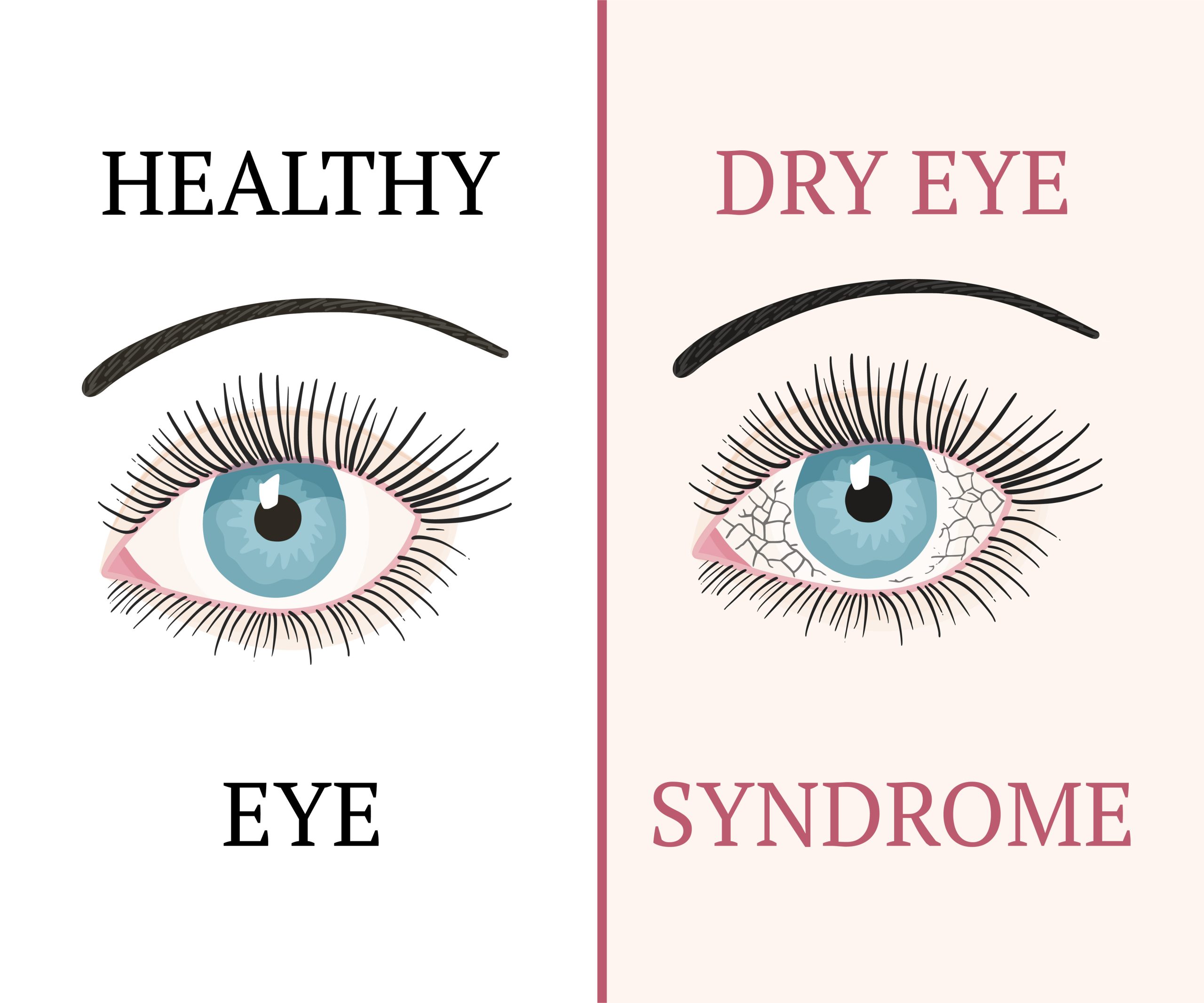 Clear healthy eyes after dry eye treatment at Honolulu wellness clinic