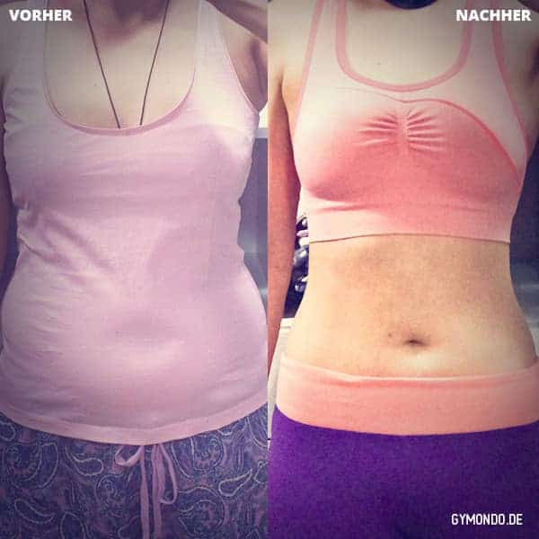 Vorher Nachher Bild frontal