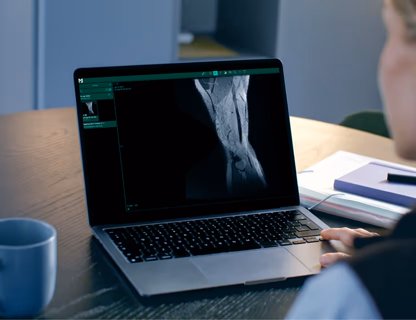 Imagistică Medicală (MSK) Movis+