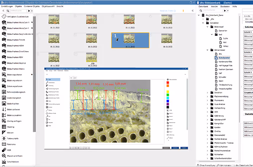 Bildanalyse Software für Mikroskope, Analyse