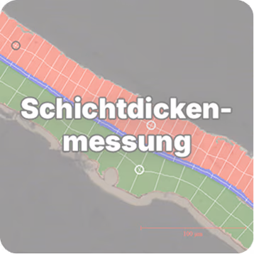 Bildanalyse Software für Mikroskope, Phasen-/Flächenanalyse