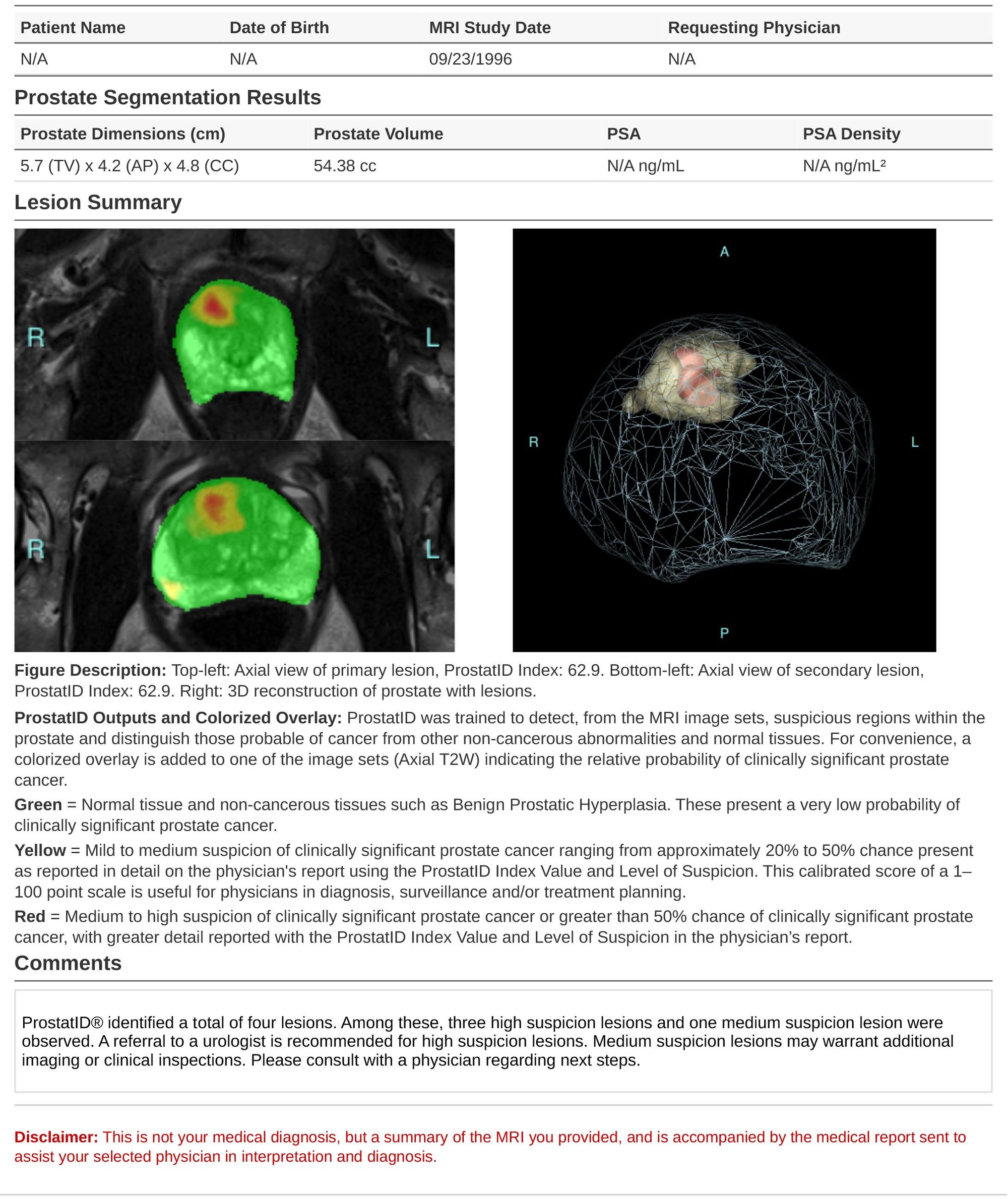 AI Second Opinion for Prostate MRI | DeepView Imaging | FDA-Cleared AI