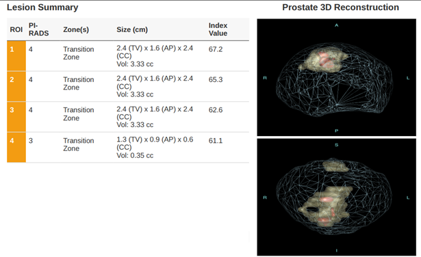 Sample DeepView Imaging AI Report with Detected Lesions Shown in 3D