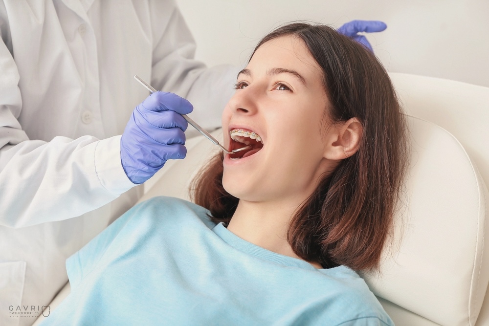Braces Cost in Richmond, TX: Costs & Options