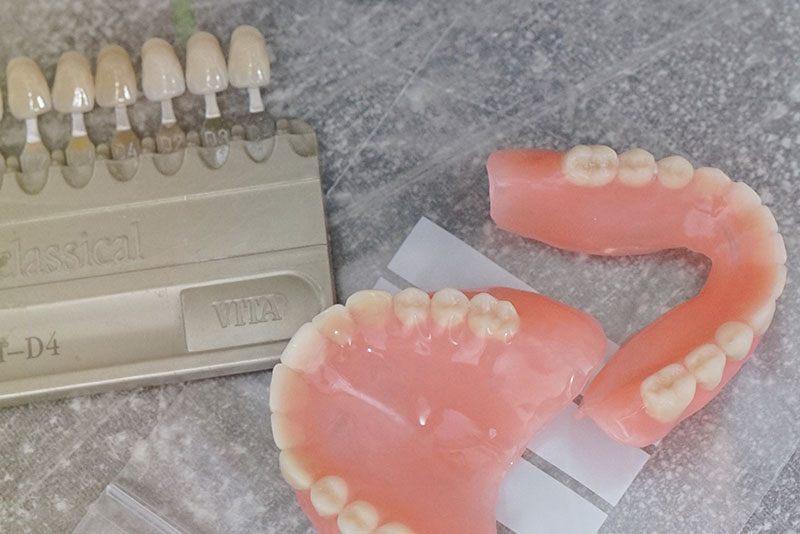 Erikoishammasteknikko