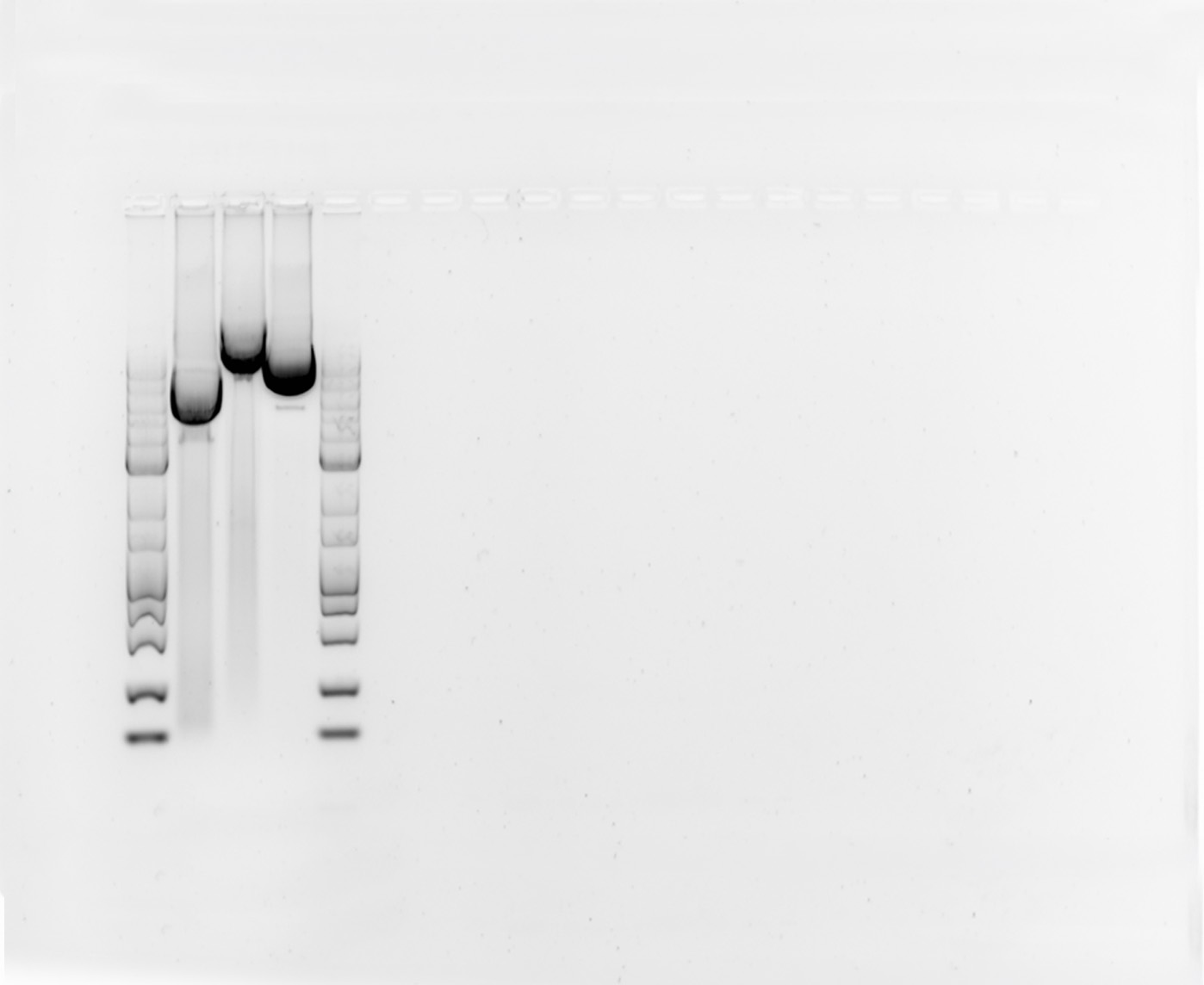5 Guidelines for Selecting Loading Controls in Quantitative Western Blotting