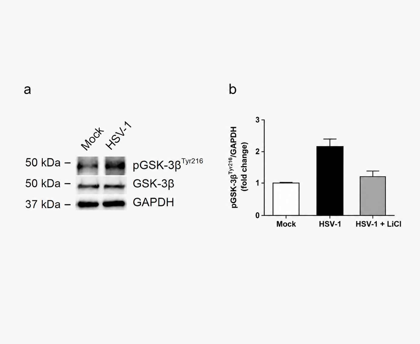 A Common Virus, a Complex Disease: New Insights into Alzheimer's Progression