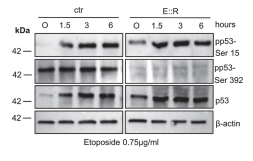 Targeting the Hidden Survival Mechanism of Pre-Leukemic Cells