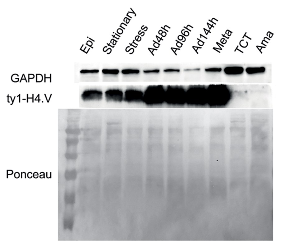 Characterising a novel histone variant in Trypanosoma cruzi