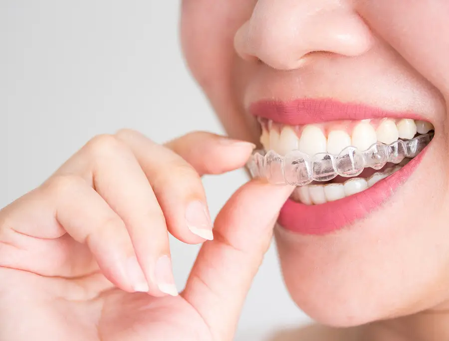Close-up of a person smiling while holding a clear dental aligner near their teeth.
