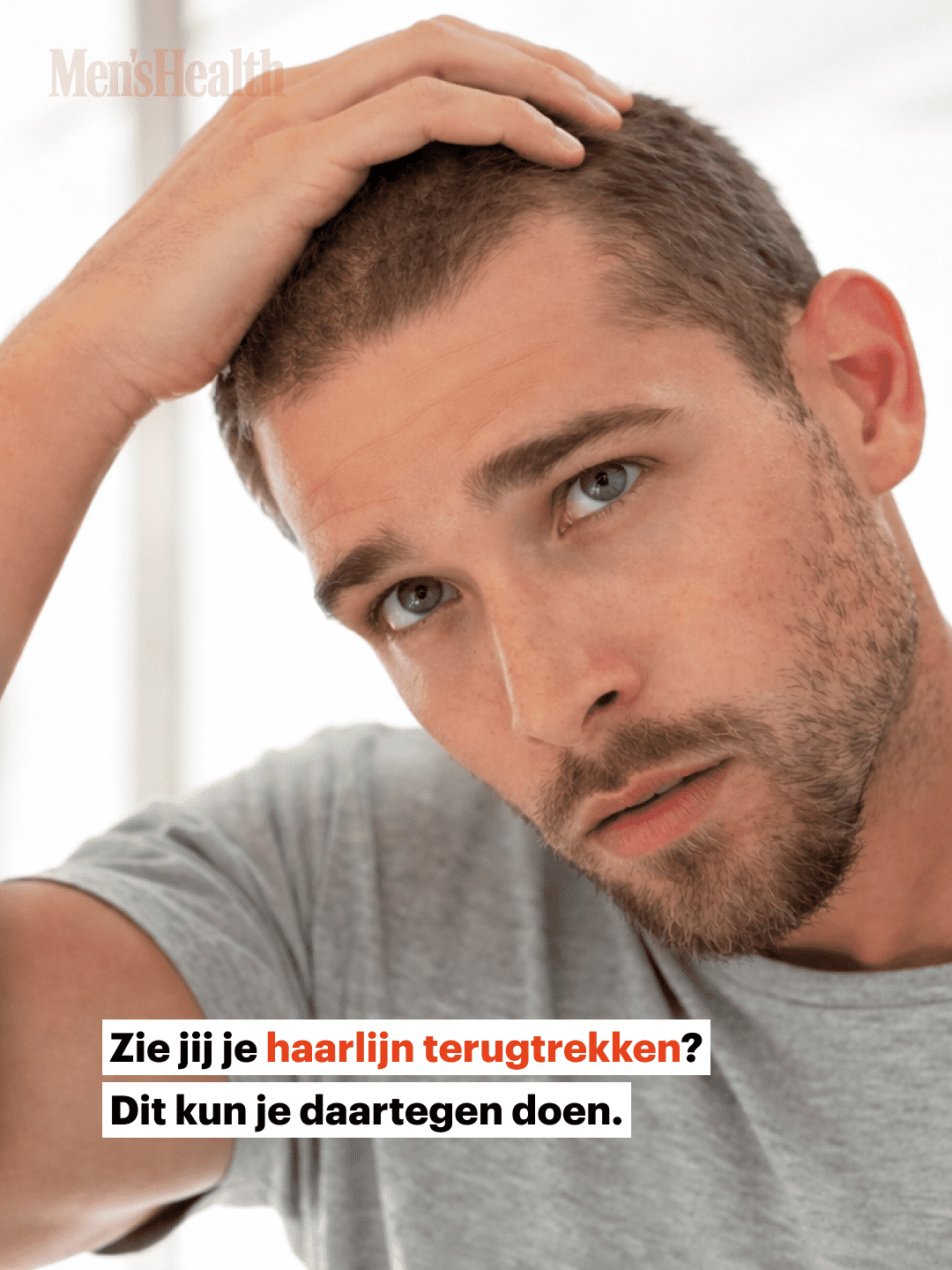 3CO in de media: inzichten over haaruitval in Men's Health