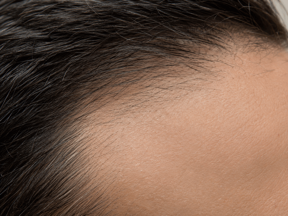 Finasteride resultaten: wat kun je verwachten en wanneer?