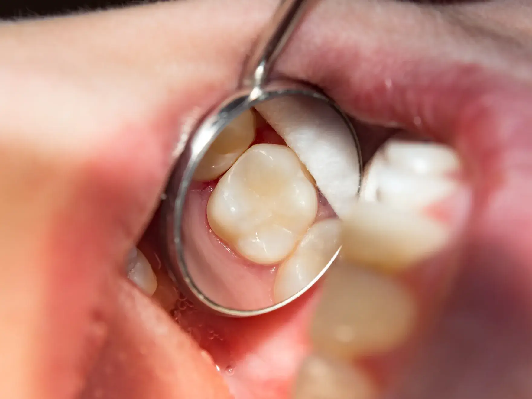 A close up of a person holding a pair of scissors.