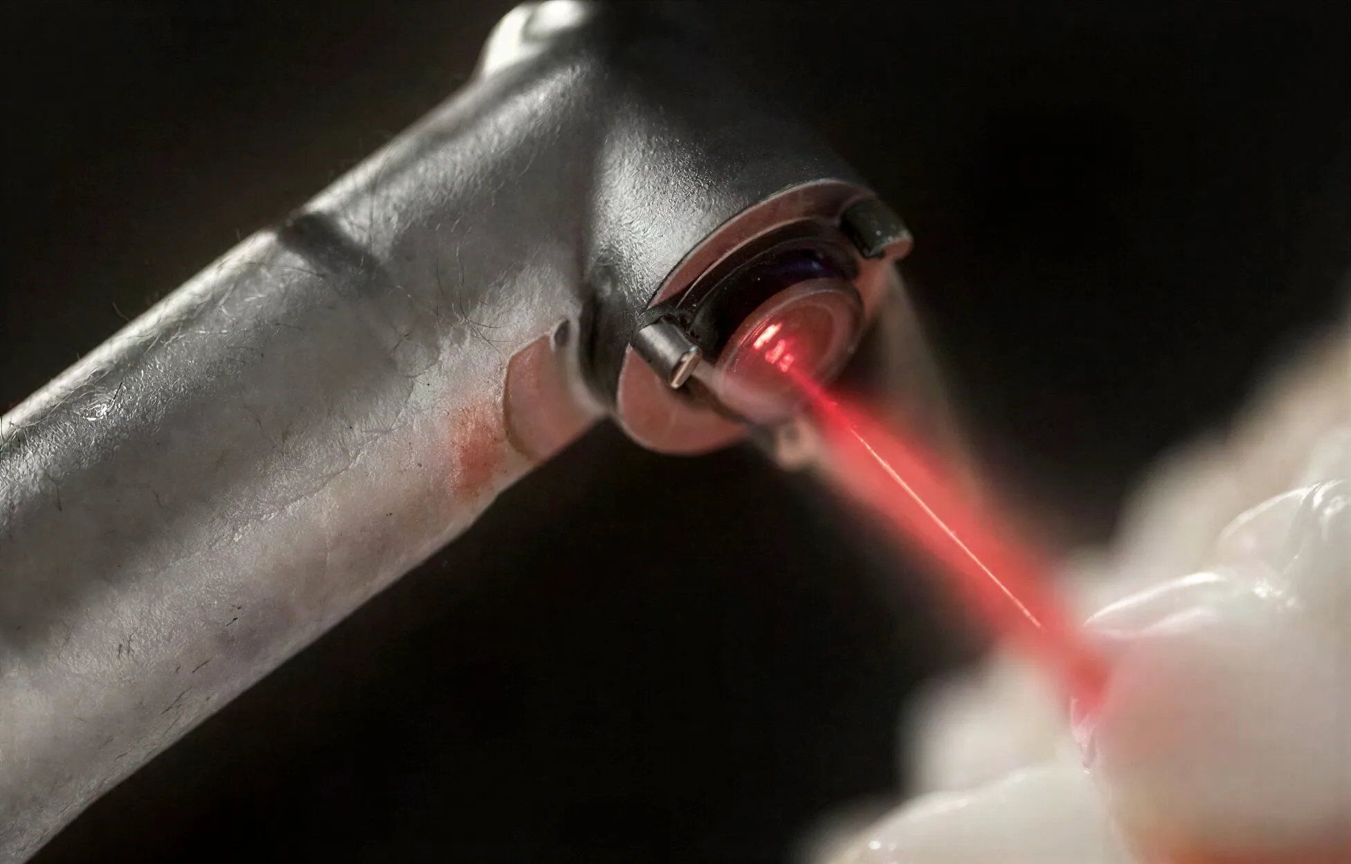 Soft-Tissue Diode Laser