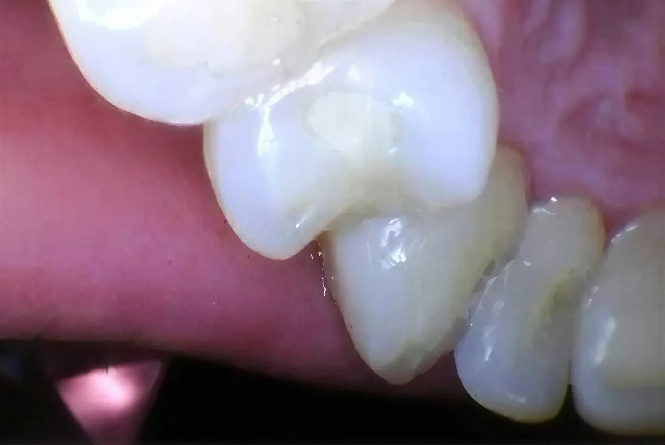 Intraoral Photography