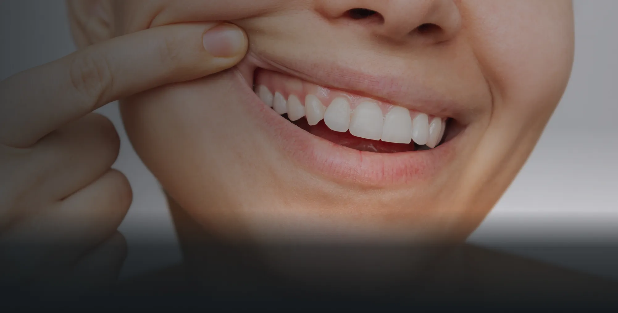 Close-up of a smiling person pulling cheek to show clean, white teeth.