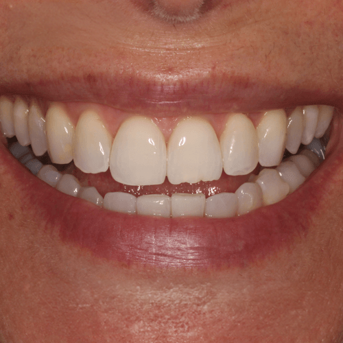 Pre-Op dental examination