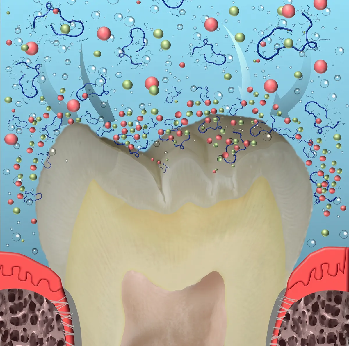 Cross-section of a tooth with surrounding bone and gum tissue, showing particles and molecular chains breaking down the tooth surface.