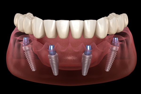 Core Smiles dental treatment