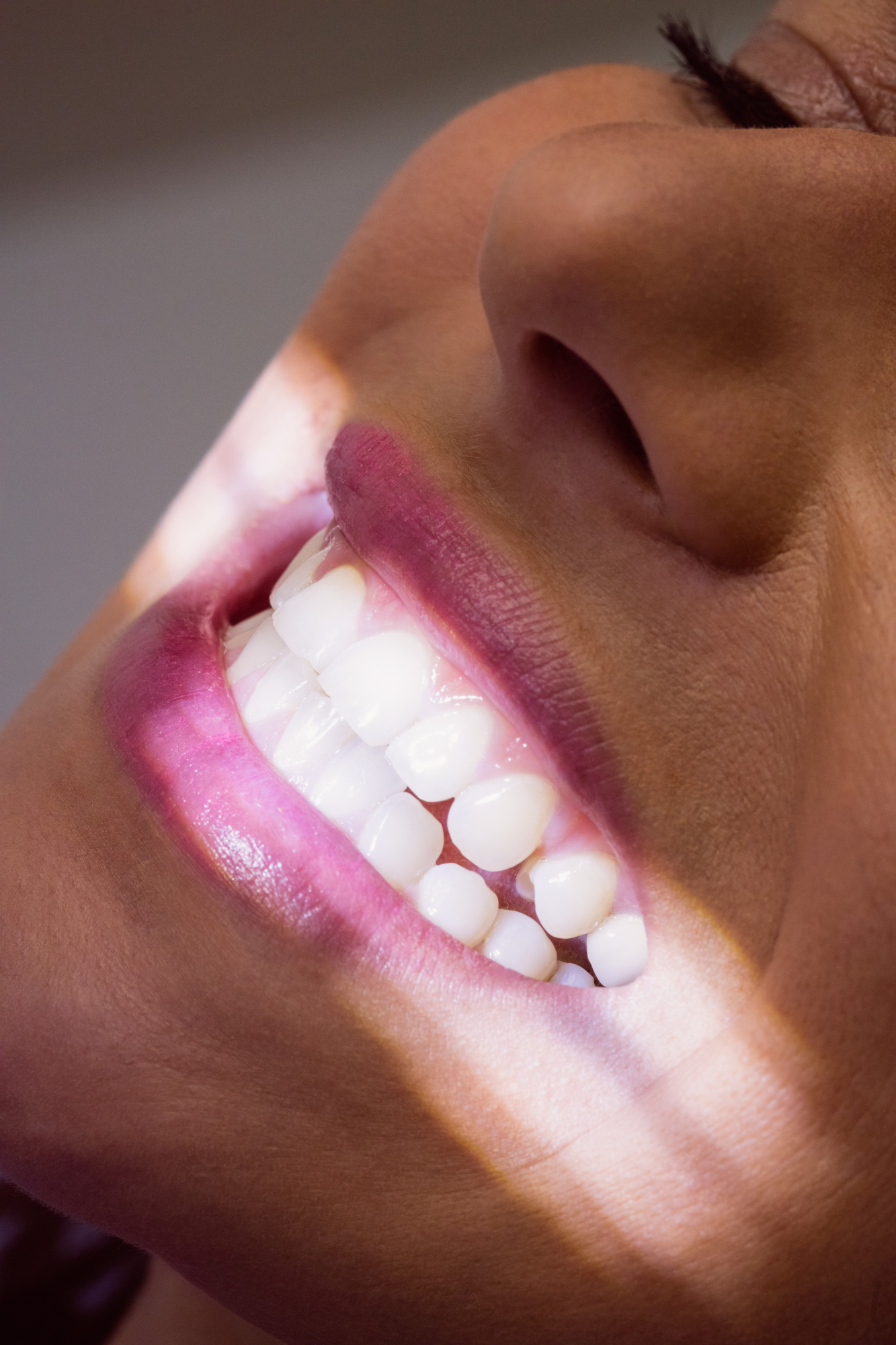 Core Smiles dental treatment