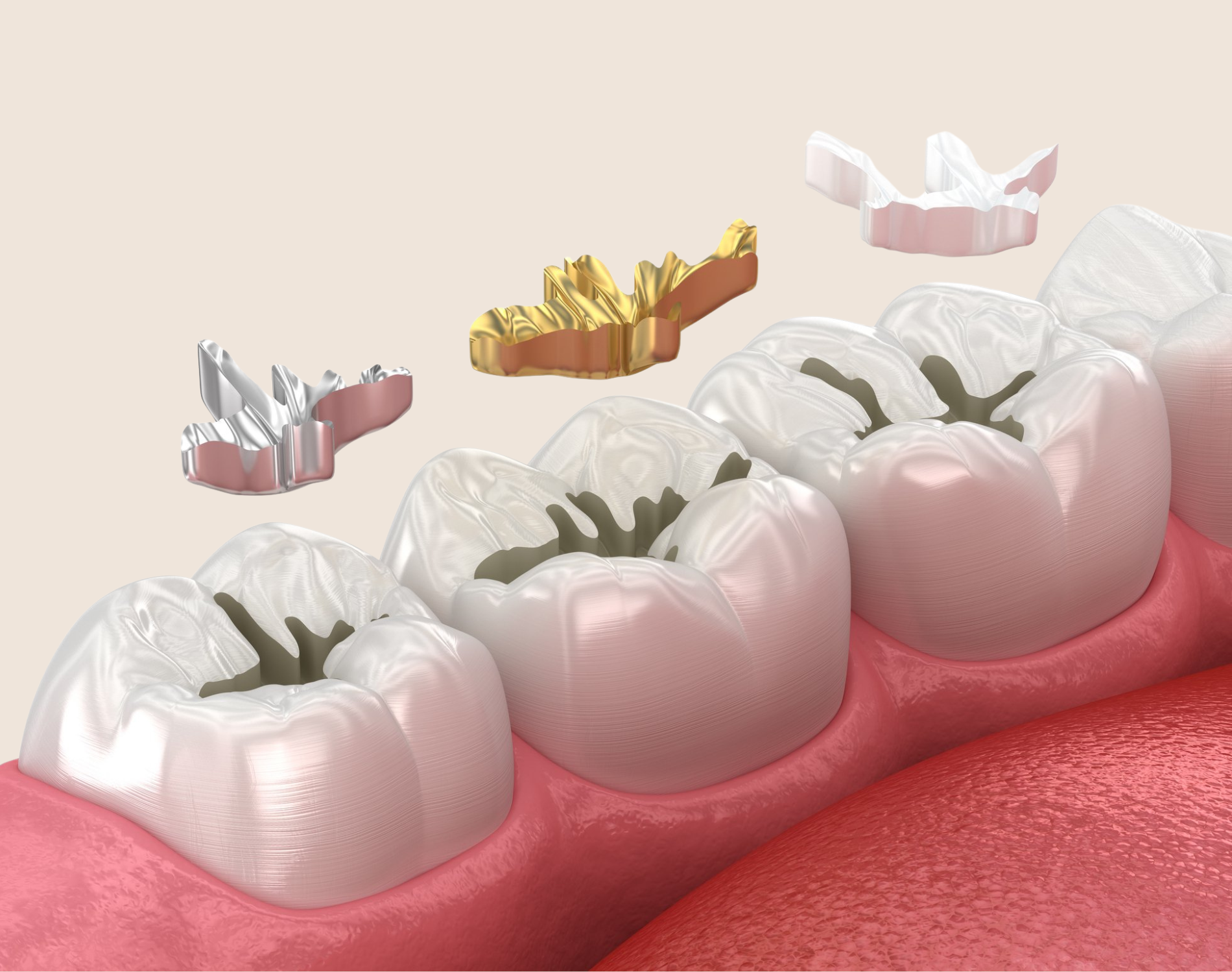 Core Smiles dental treatment