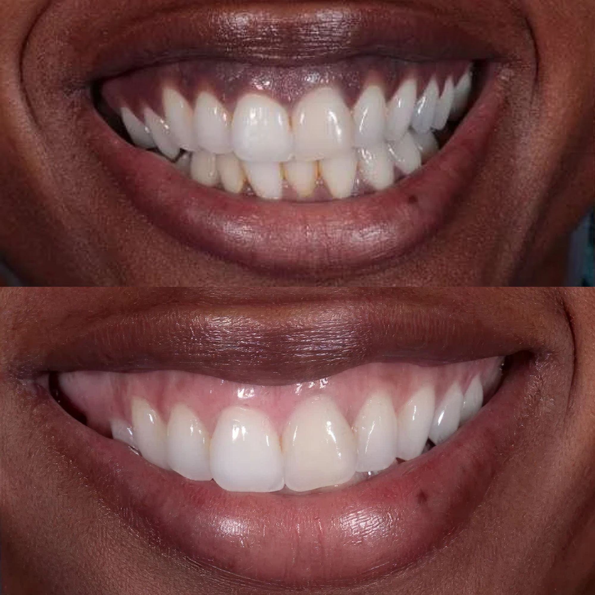 Treatment visualization