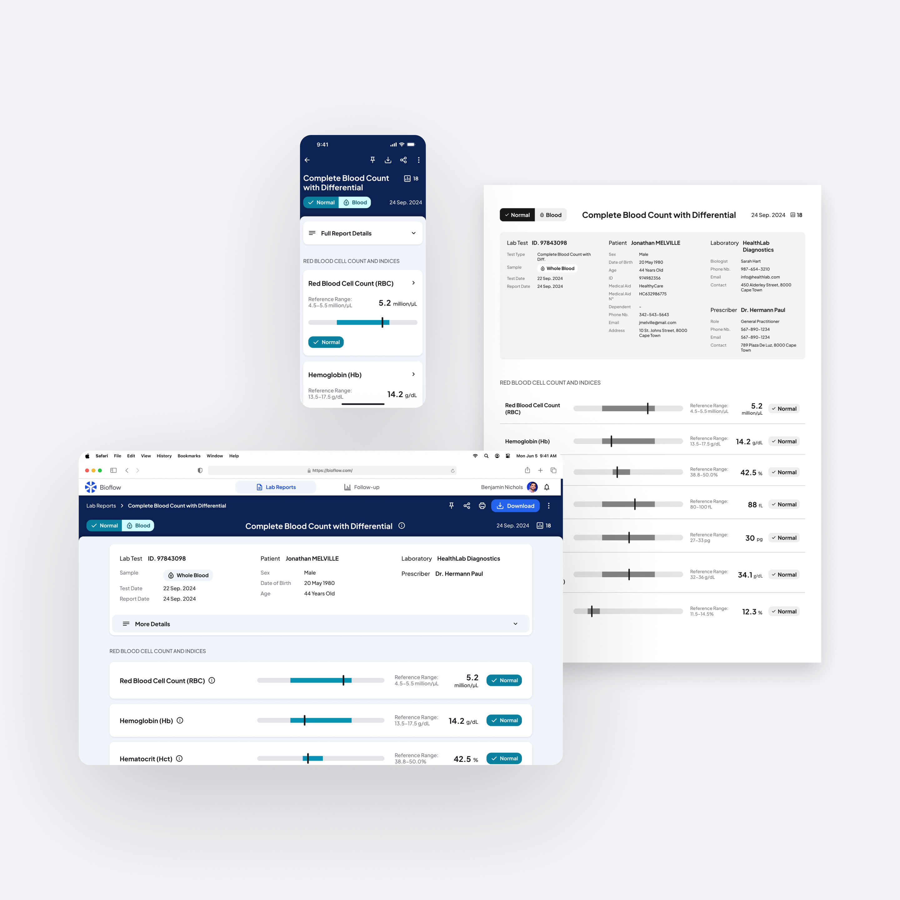 Different formatting options for a lab test report on the Bioflow platform, including desktop, mobile, and printed A4 versions.