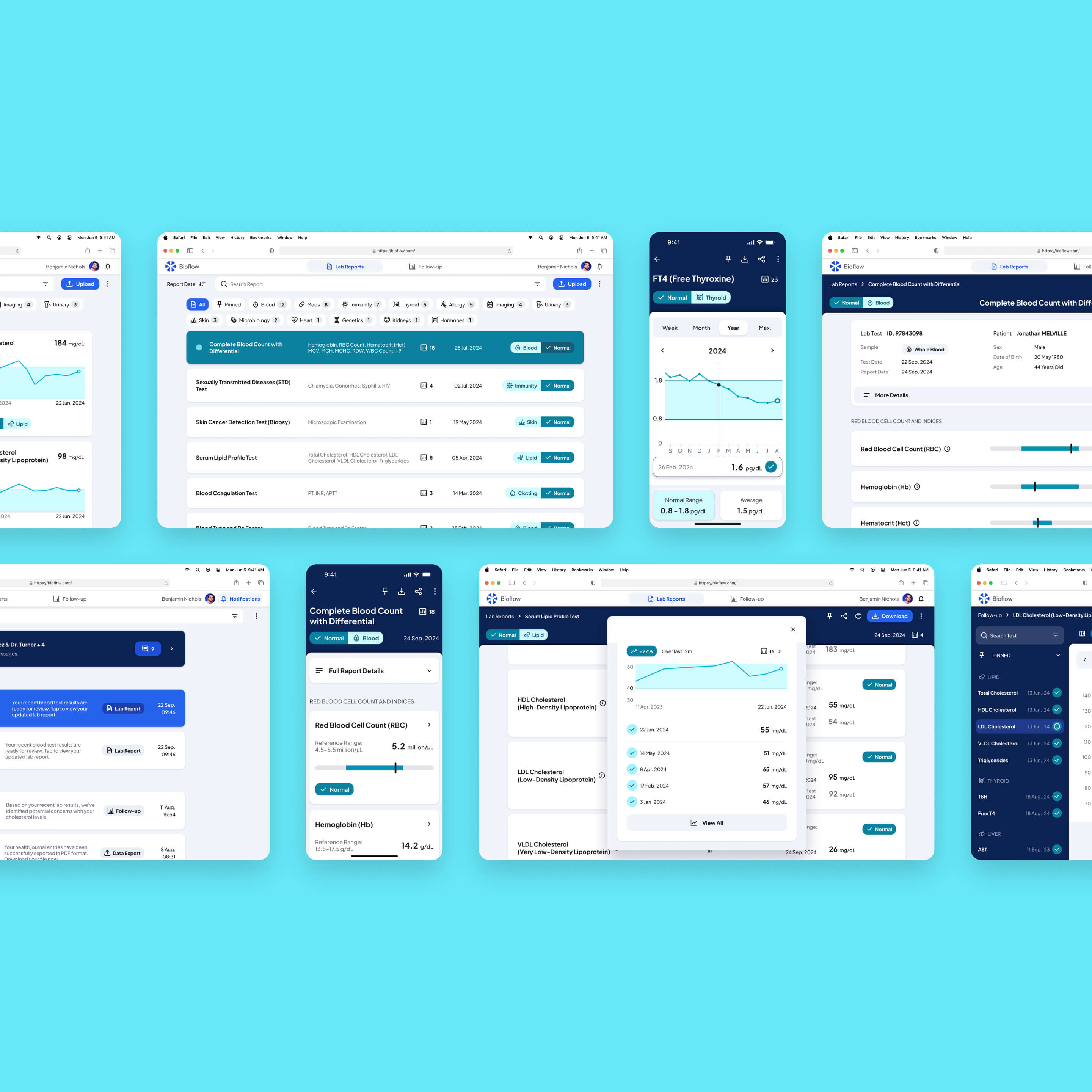 Various lab test report views in the Bioflow platform, designed with hierarchy and highlights to enhance scanability.