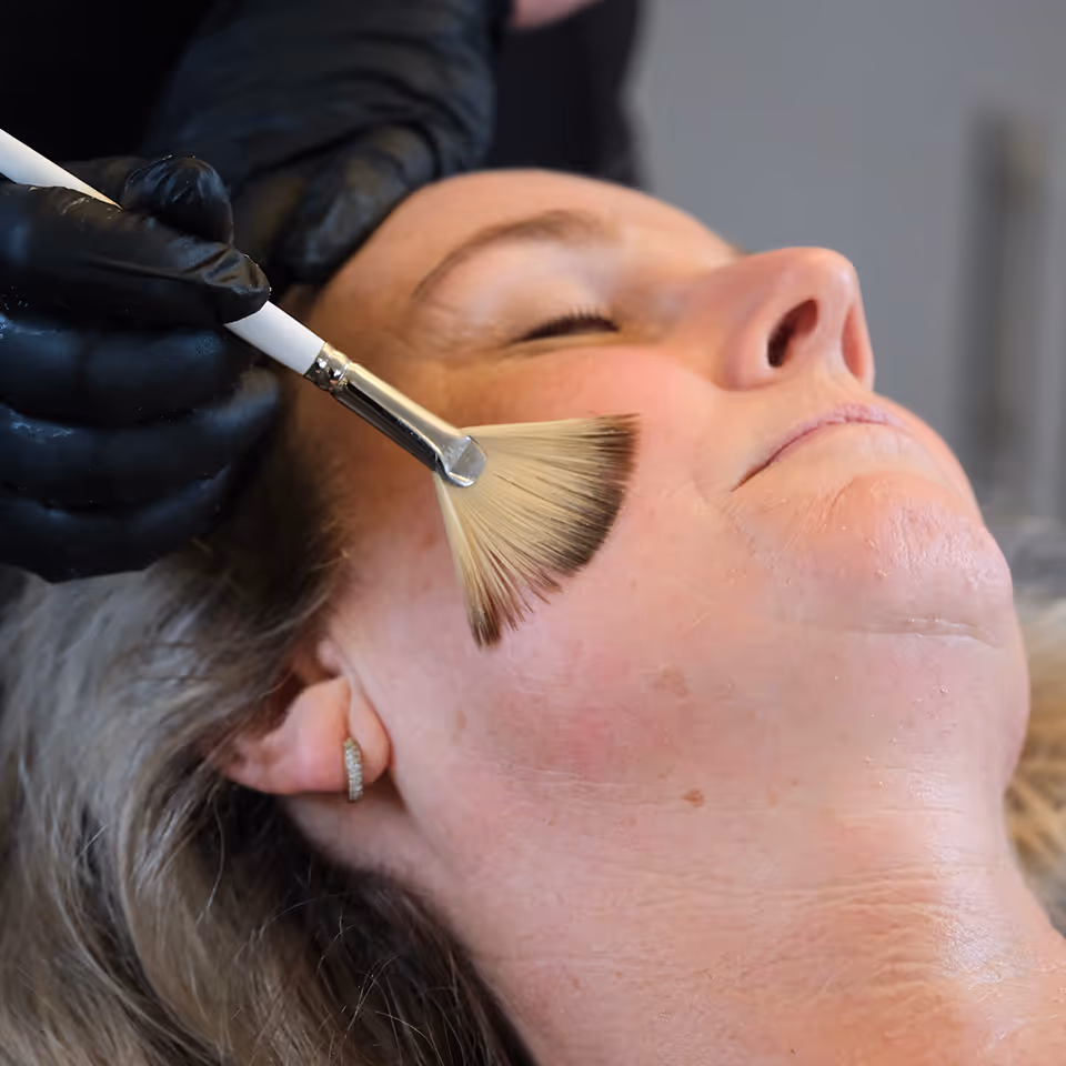 SQT Biomicroneedling, intensieve, natuurlijke huidvernieuwing
