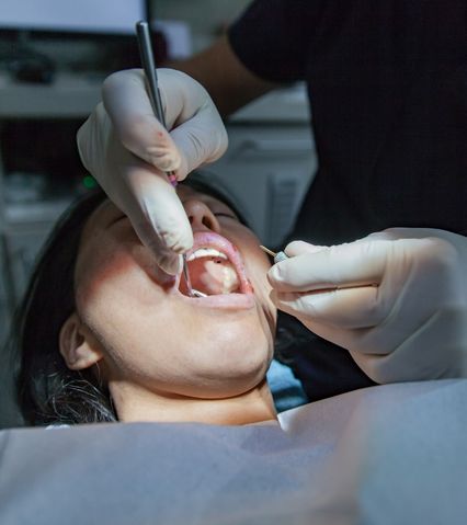 Pacient la dentist cu gura deschisă în timpul unui control stomatologic efectuat cu instrumente dentare.