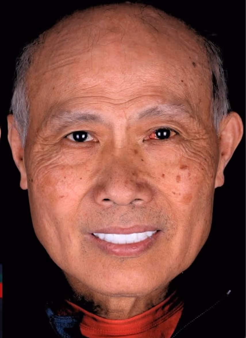 Close-up of an elderly man smiling with a bald head and some visible skin spots on his face.