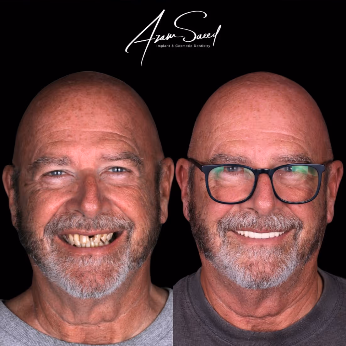close up before and after results middle aged man 