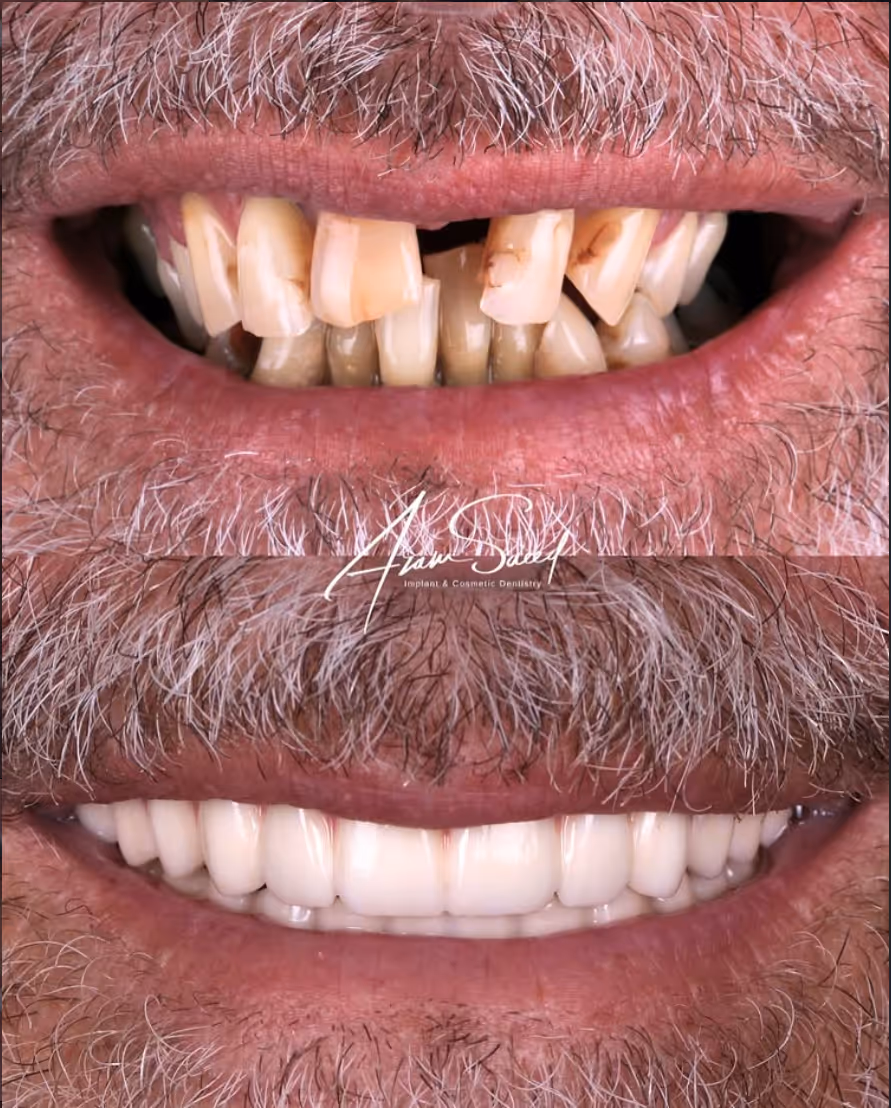 before and after results middle aged man 