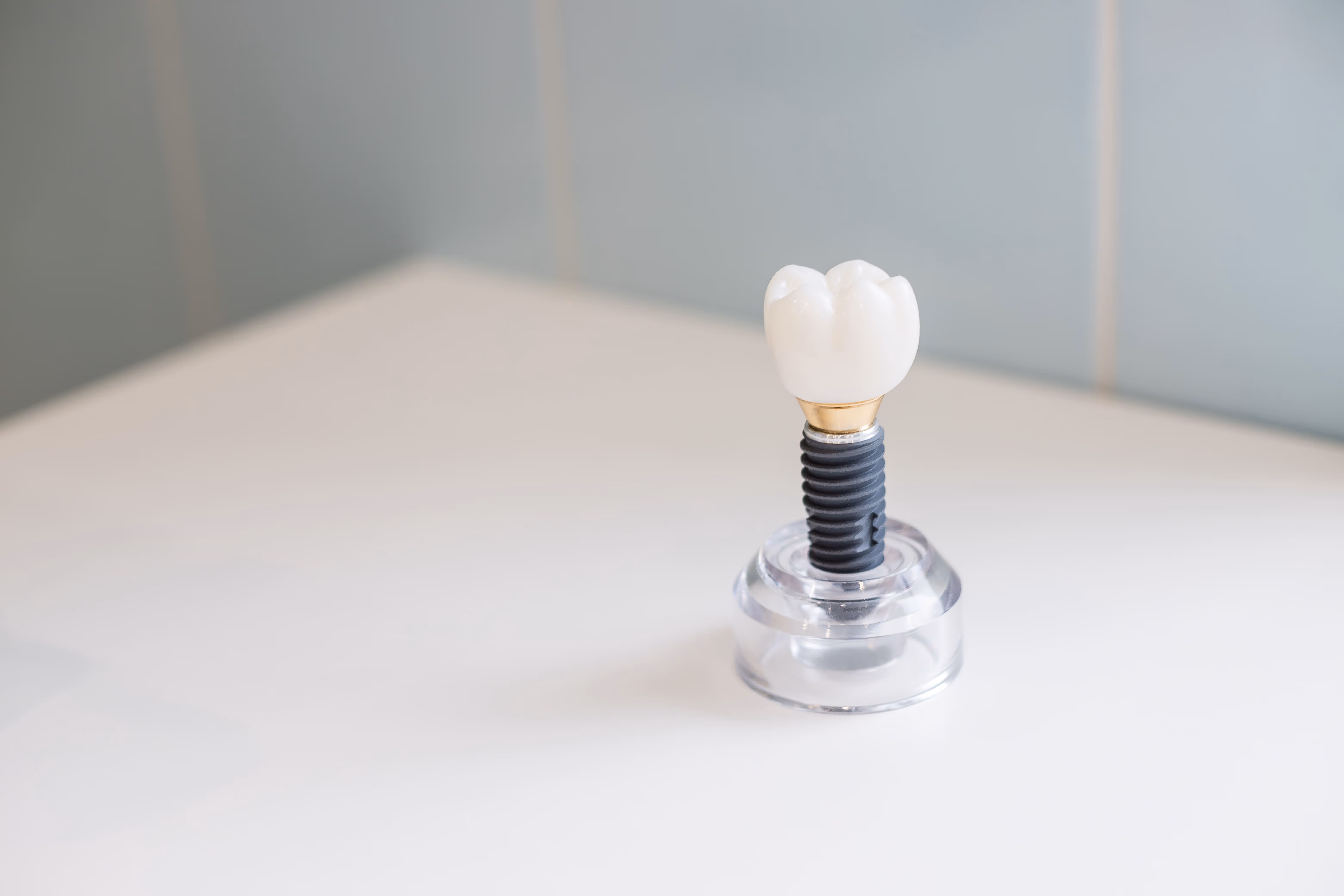 single tooth implant crown