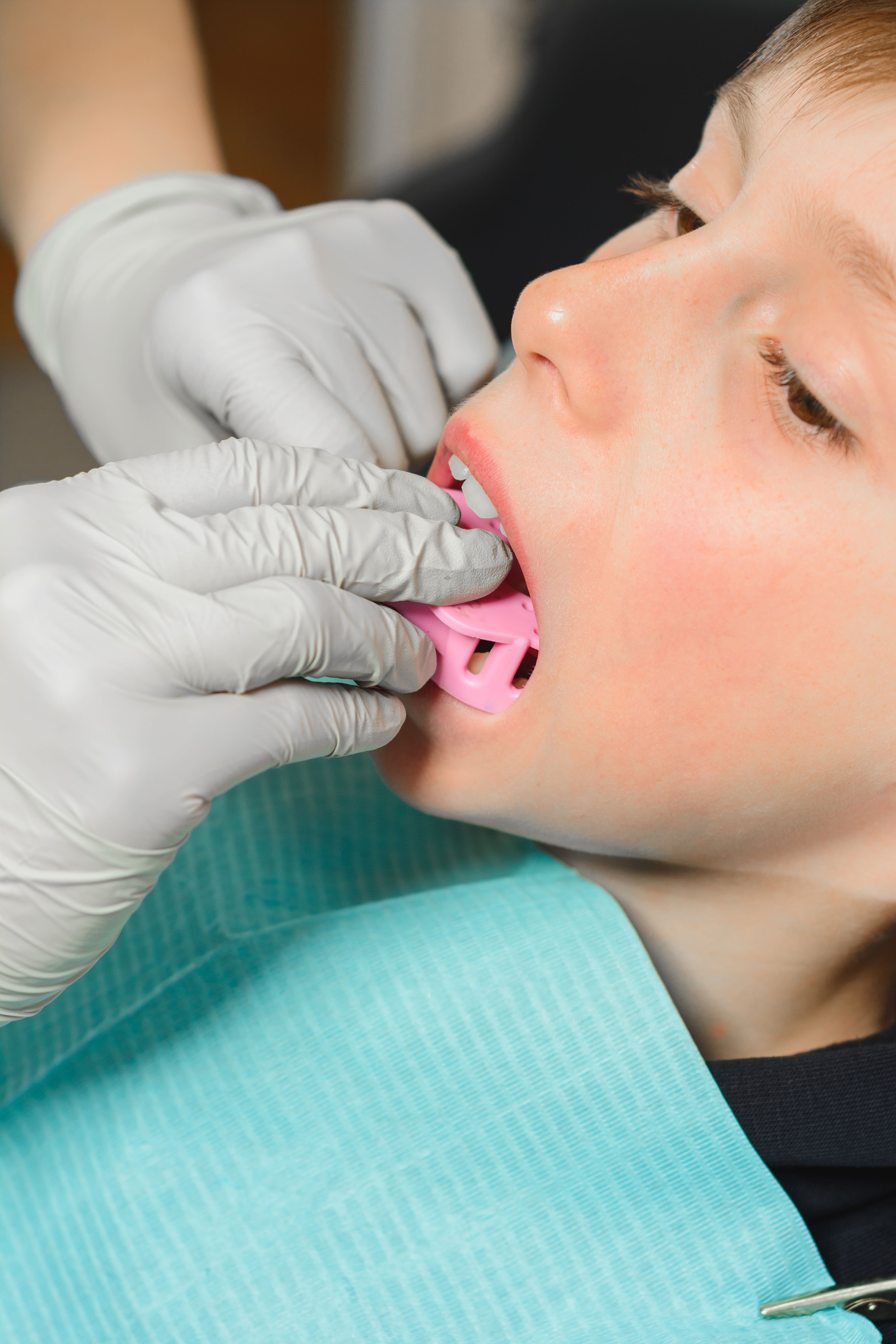 Clinician fitting a young patient with a pink myofunctional oral appliance at South Bay Dental Loft
