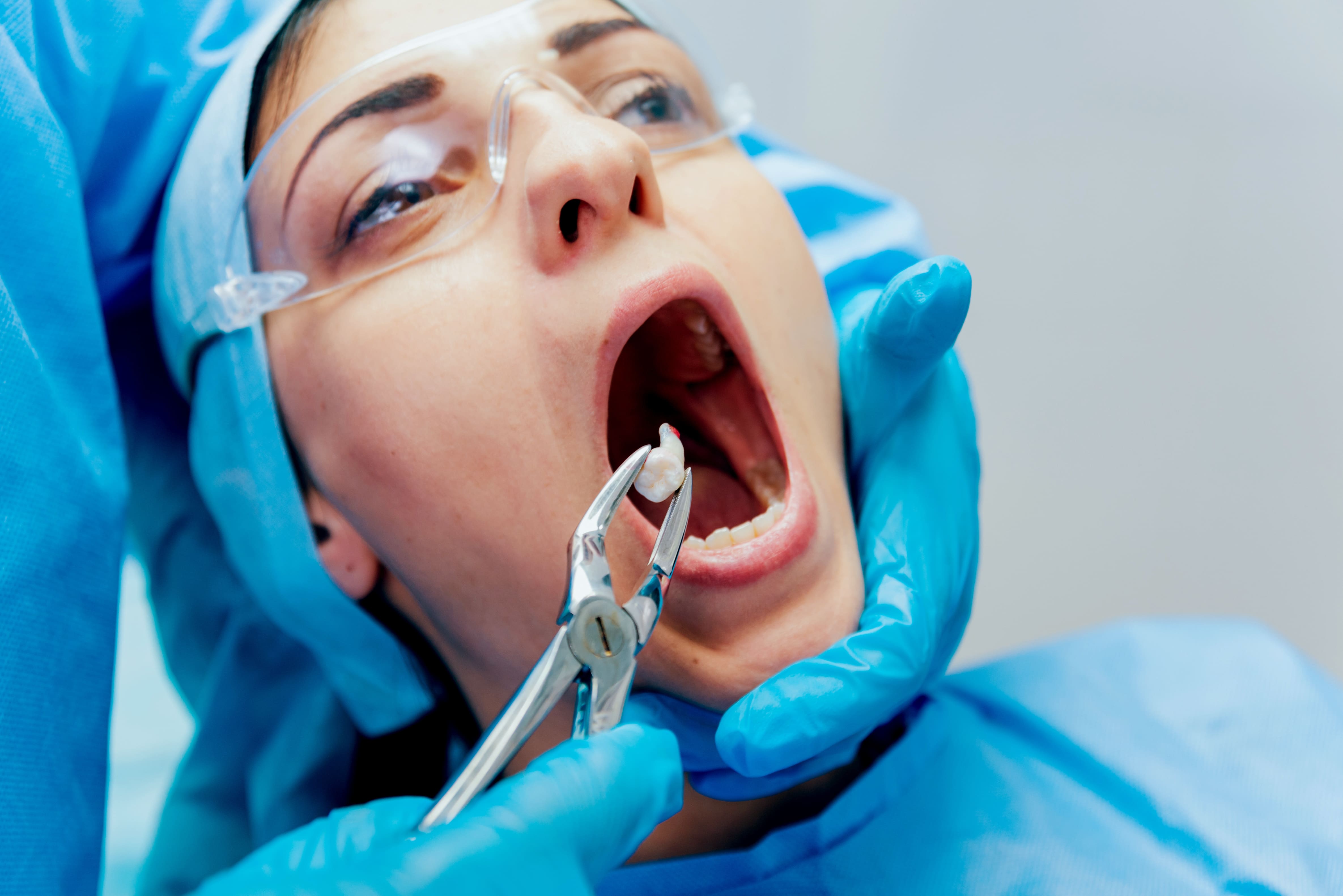Dentist performing a tooth extraction on a patient