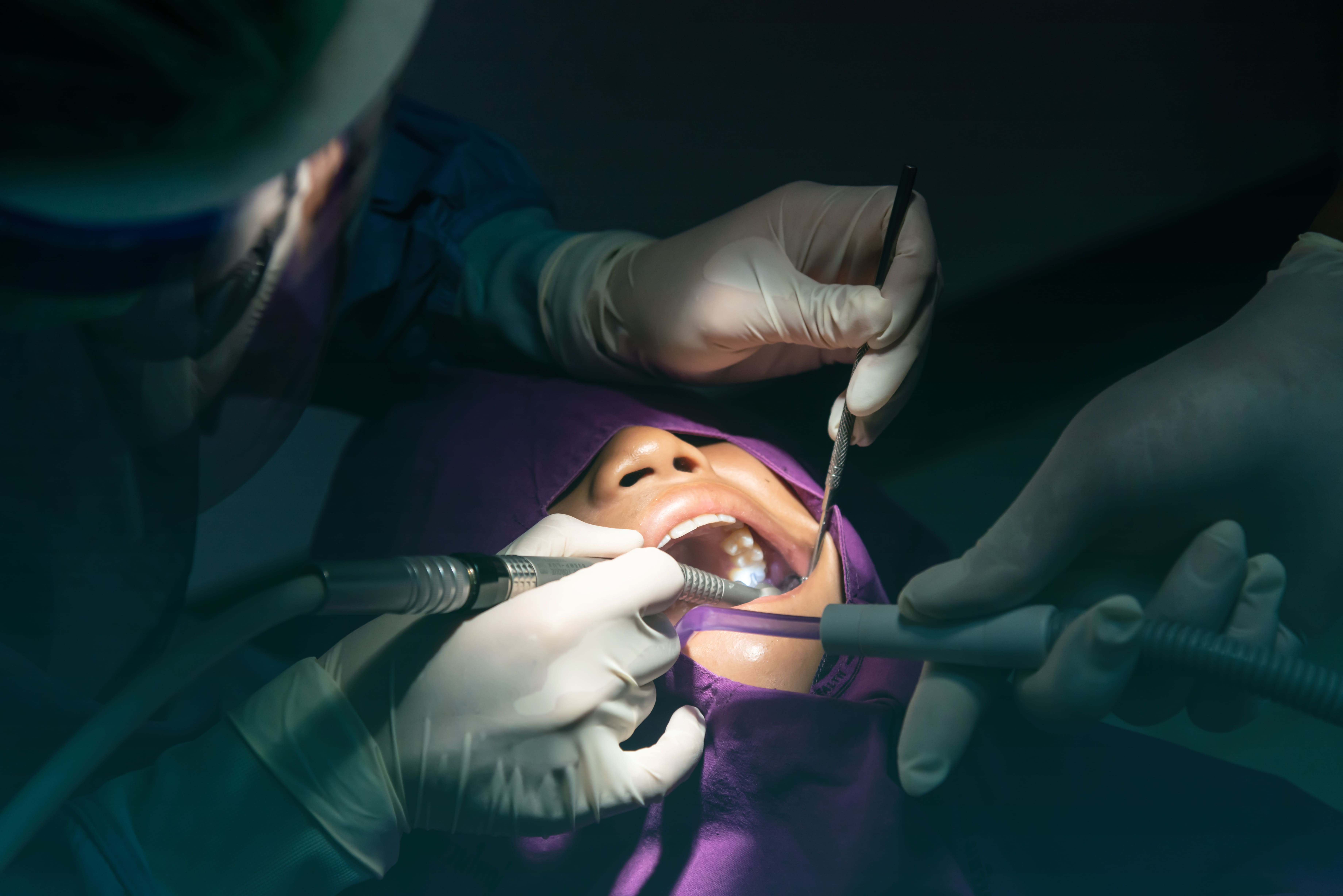 Oral surgery team performing a wisdom tooth removal procedure