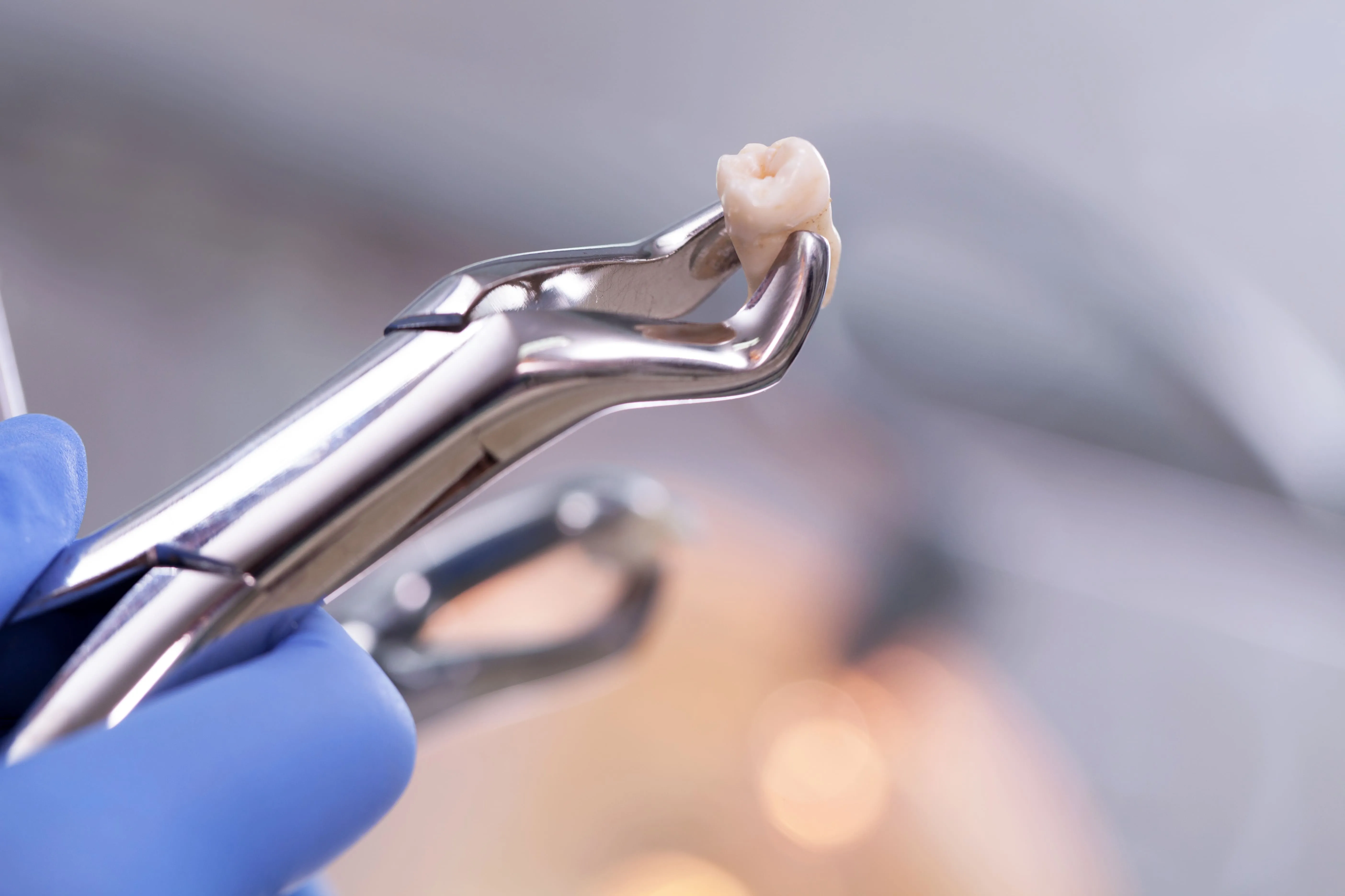 Extracted molar held in dental forceps