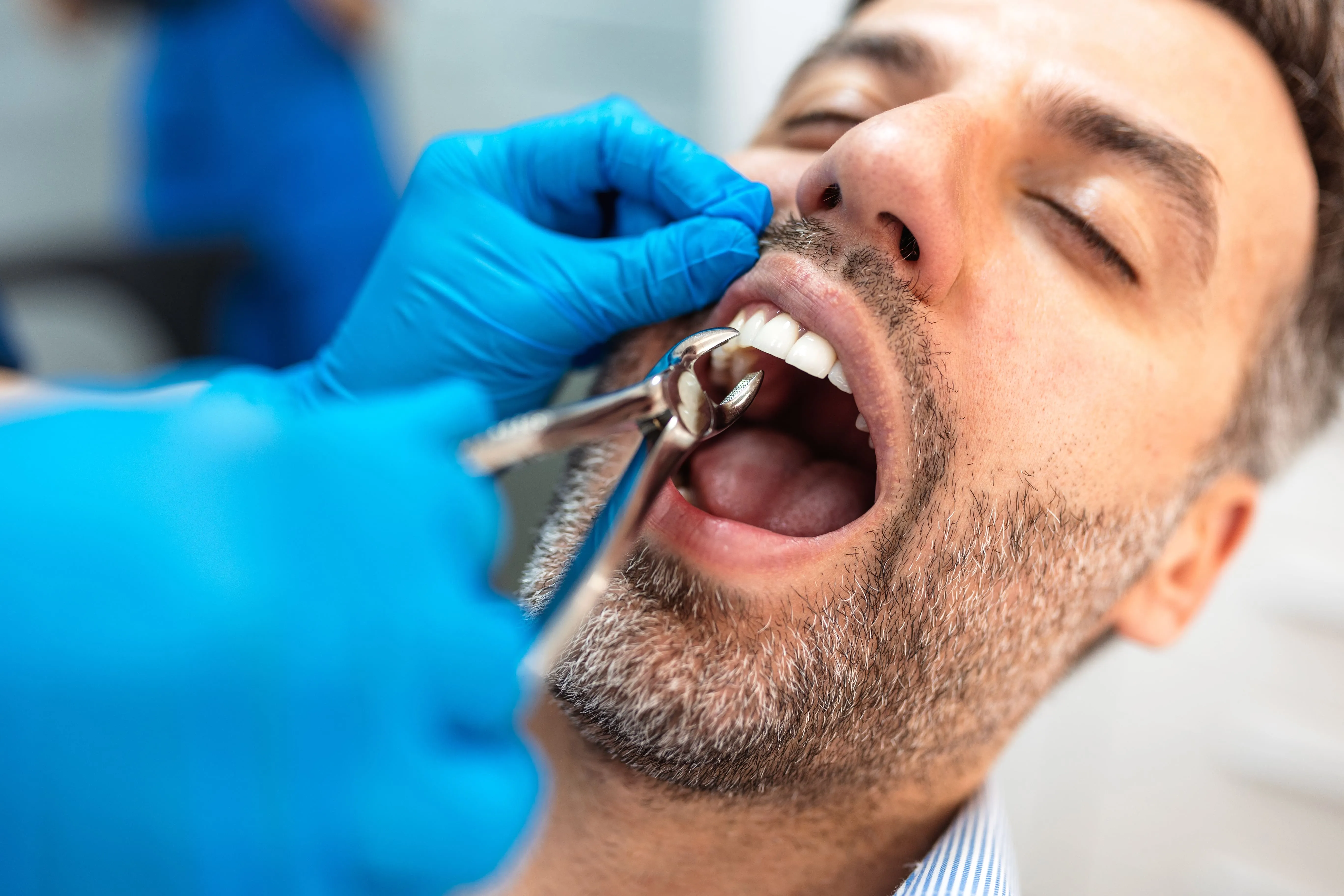 Dentist carefully extracting a tooth from an adult patient