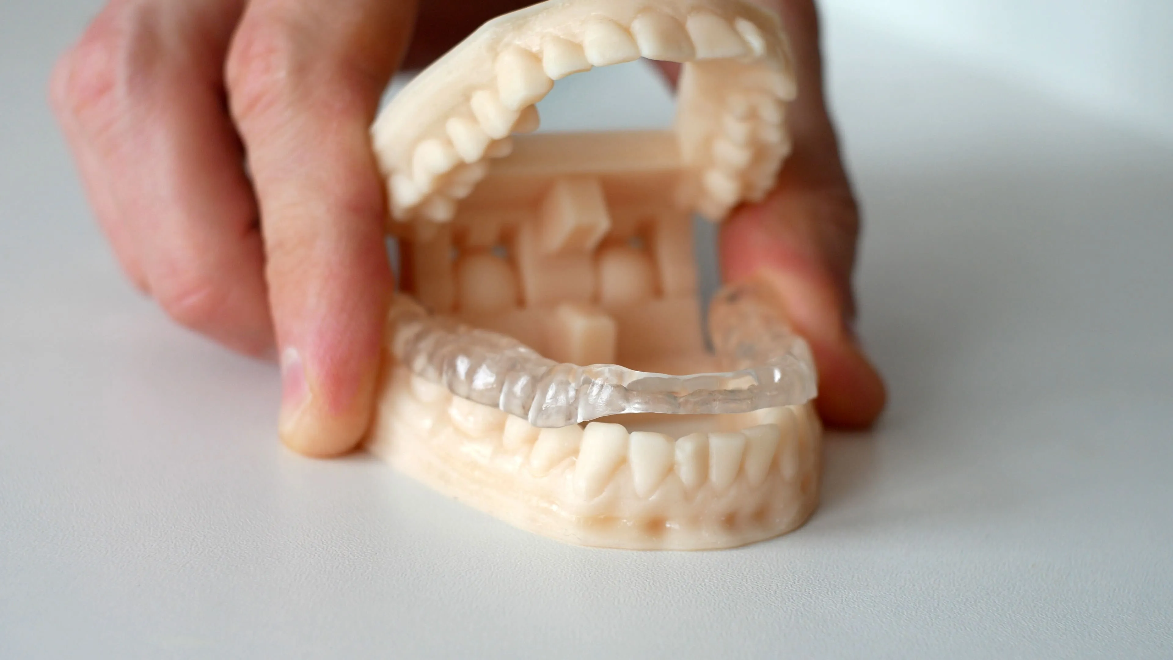 Custom oral appliance fitted on a dental model