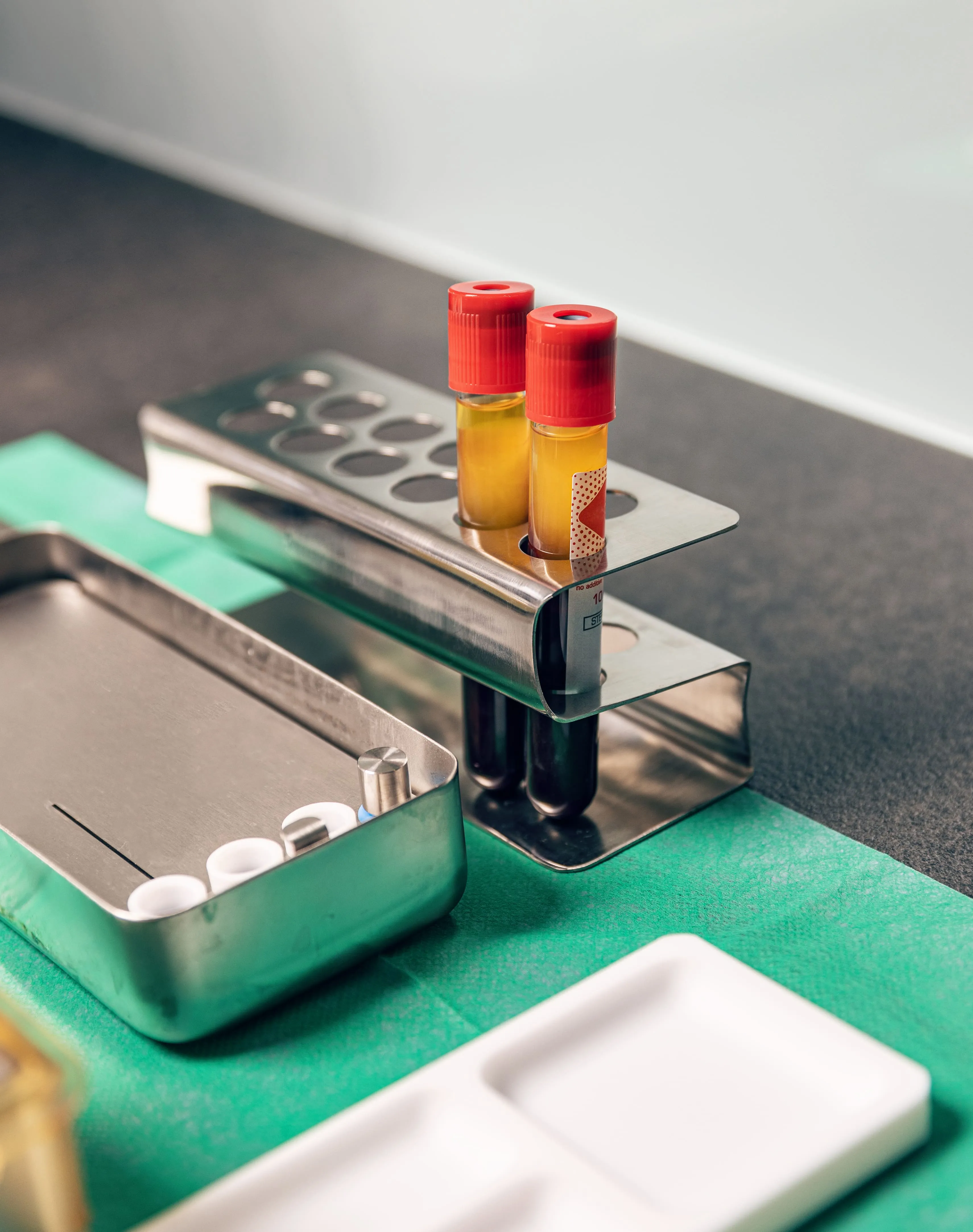 Blood sample tubes prepared for platelet-rich fibrin processing