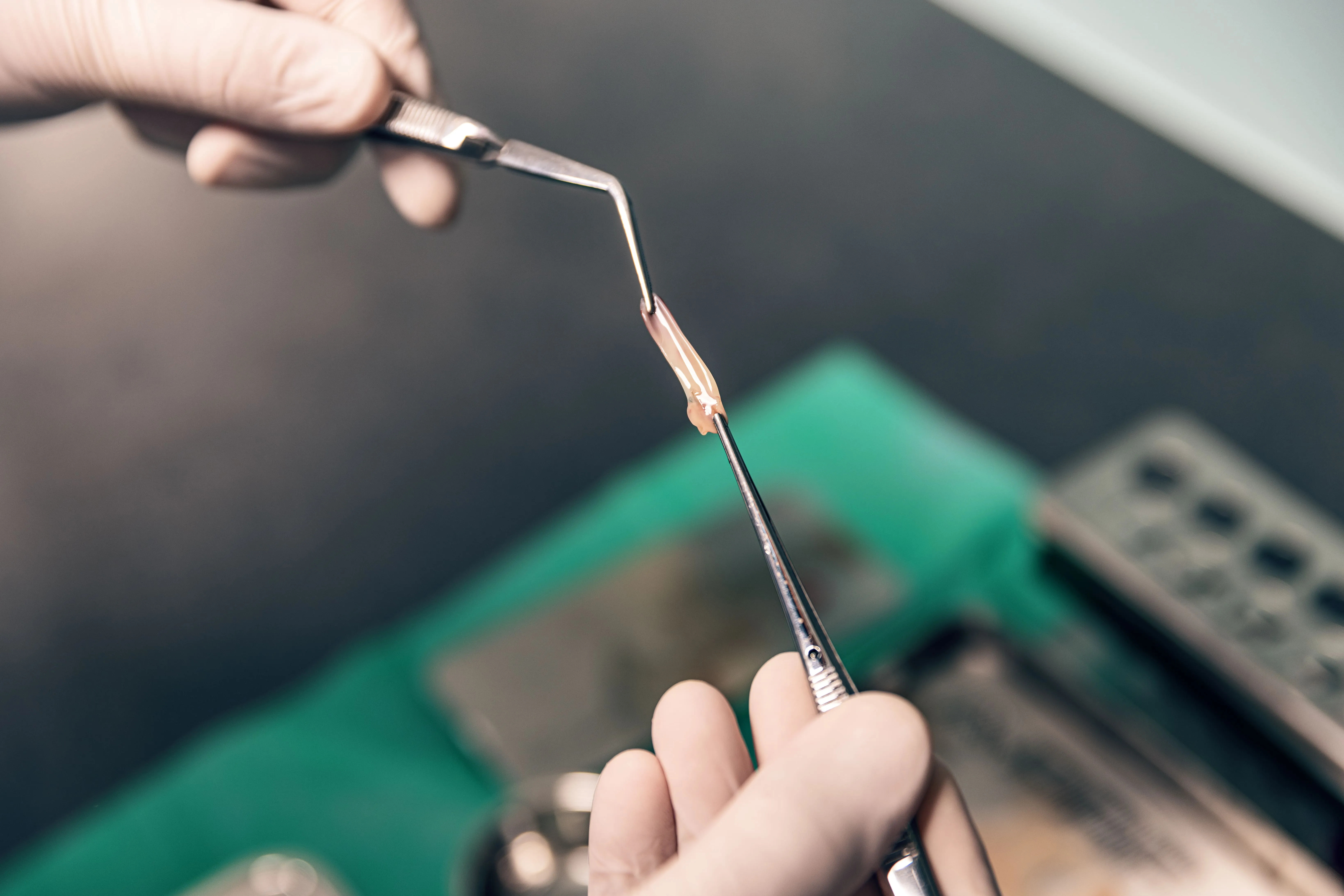 Clinician handling a platelet-rich fibrin membrane