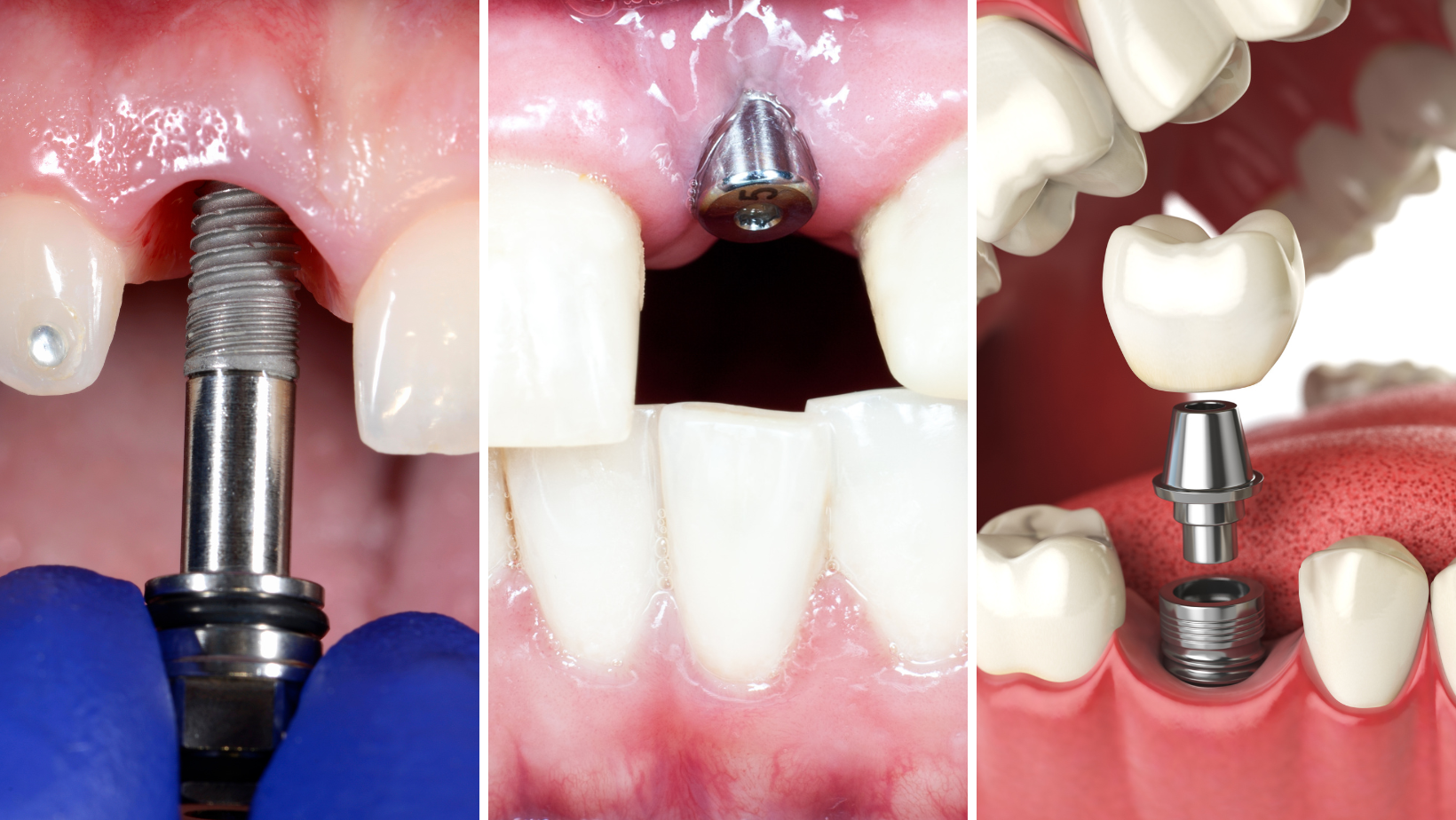 The recovery process depends on many factors