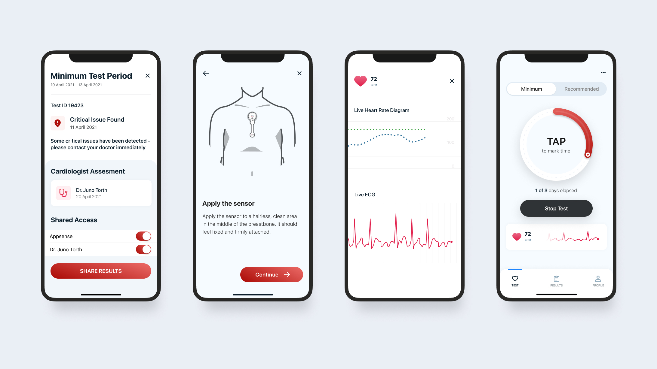 Fire skjermbilder av appen Ecg365 utvikler av Seven Peaks.