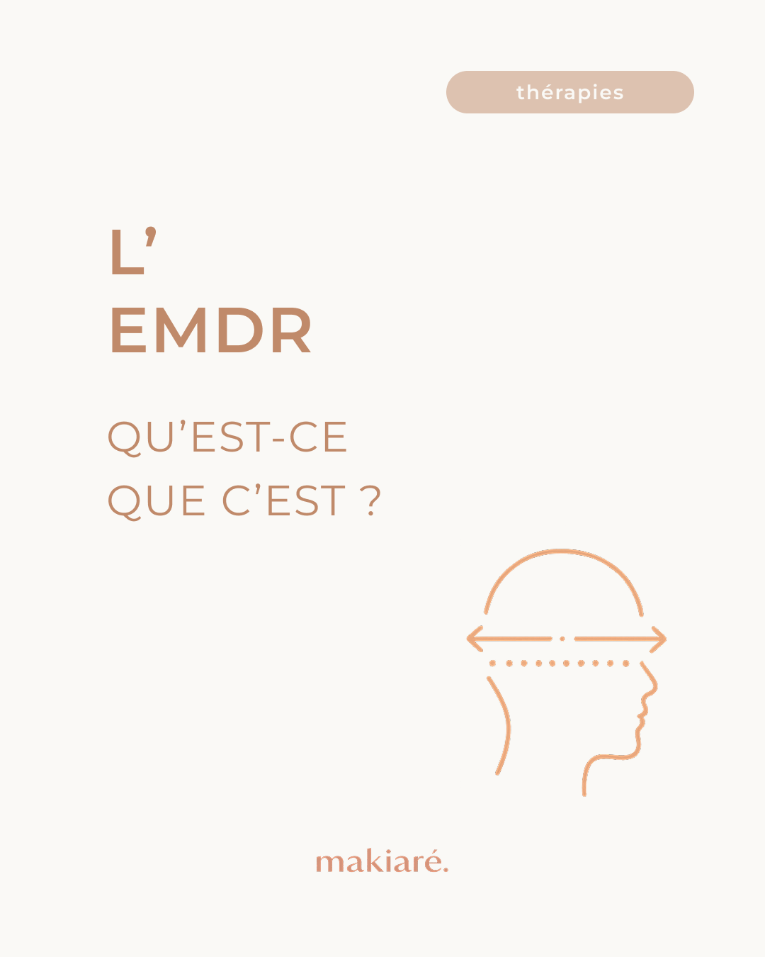 what is emdr