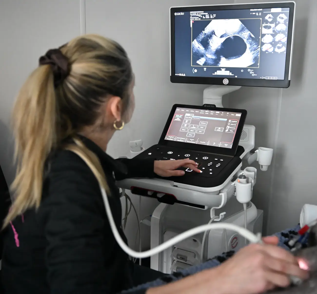 Healthcare professional performing an ultrasound scan using diagnostic equipment with an ultrasound image on screen.